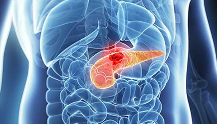 This new medicine can treat types of pancreatic cancer