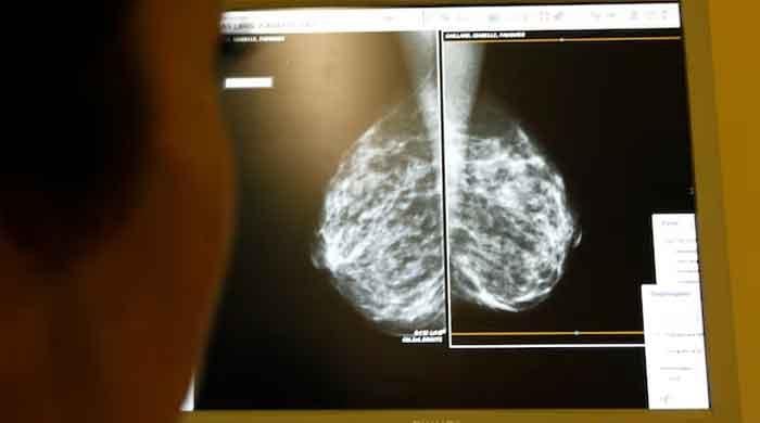 Breast cancer deaths expected to increase 68% worldwide by 2050: WHO