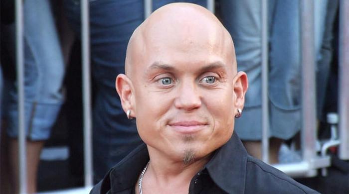 Martin Klebba claims Disney fears backlash over ‘Snow White’: Source