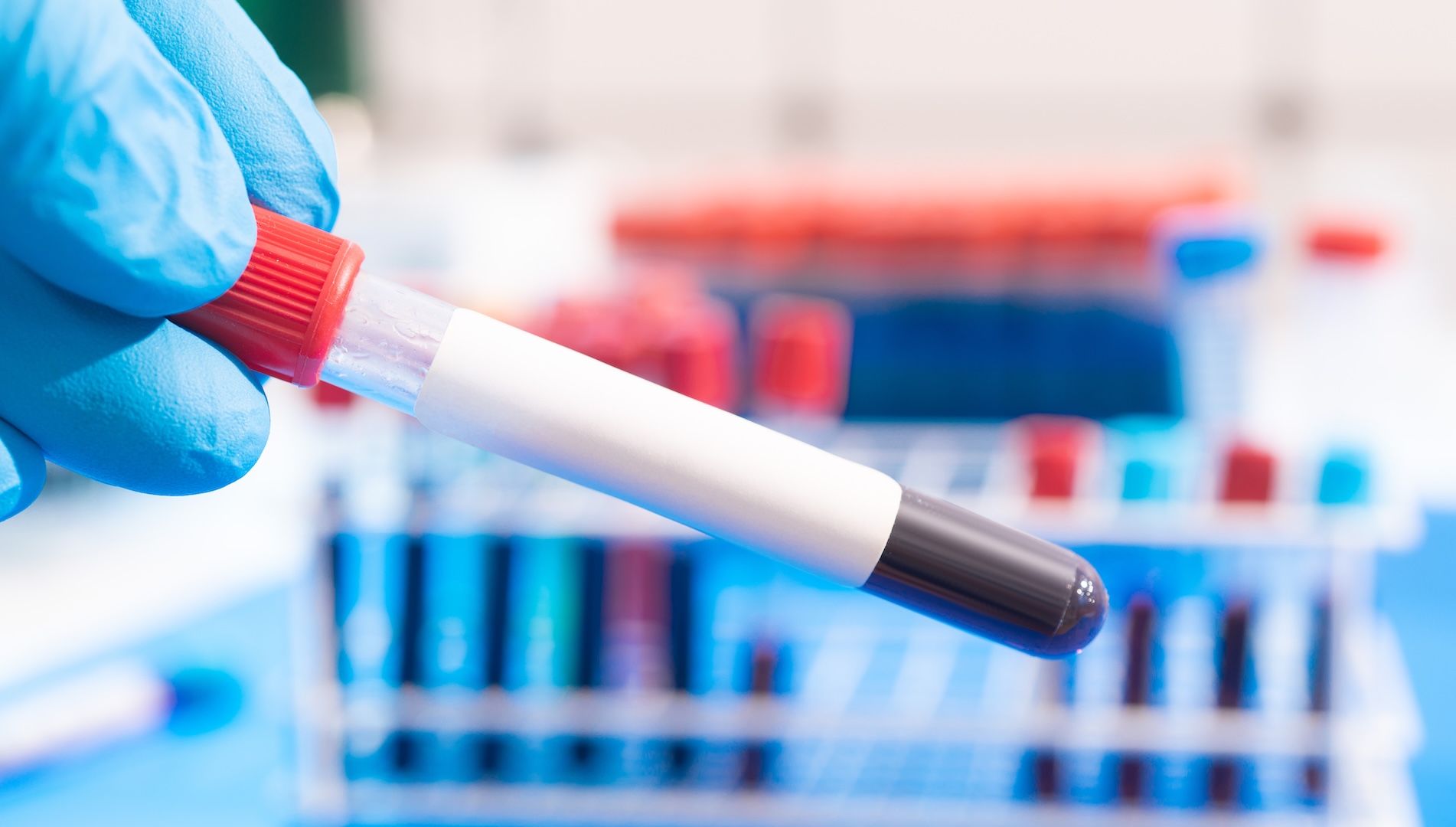 New blood test detects cancers 3 years before typical diagnosis: Experts weigh in