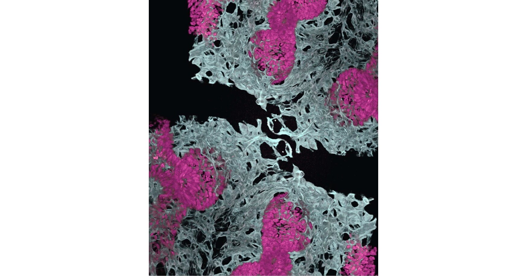 First Lung Organoid with Organ-Specific Blood Vessels