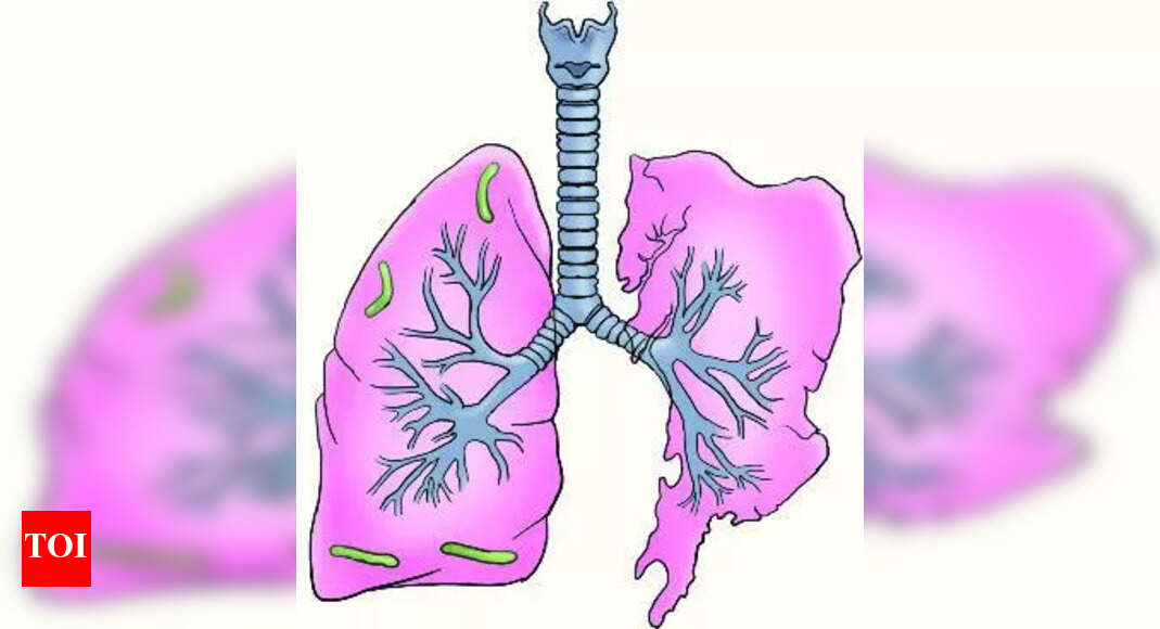 3 kids die of TB as general physicians miss early signs | Mumbai News