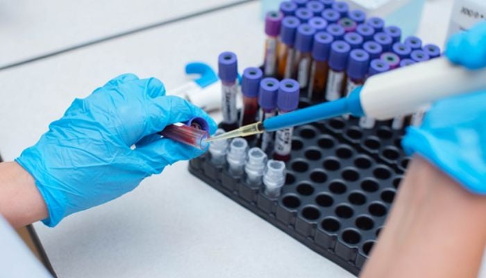 Cancer DNA is detectable in blood years before diagnosis
