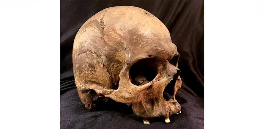 Large-scale DNA study maps 37,000 years of human disease history