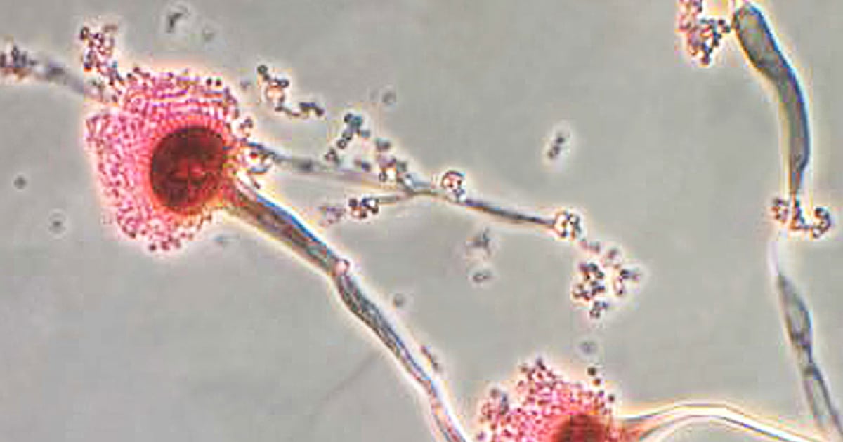 Fungal infections are getting harder to treat