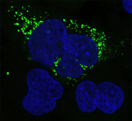 Cells express a novel ShortStop-predicted microprotein (green), with cell nuclei stained blue. The pattern suggests microproteins are localized either in endosomes, which are organelles responsible for sorting and transporting cellular cargo, or in lysosomes, which are organelles that collect and remove cellular waste.