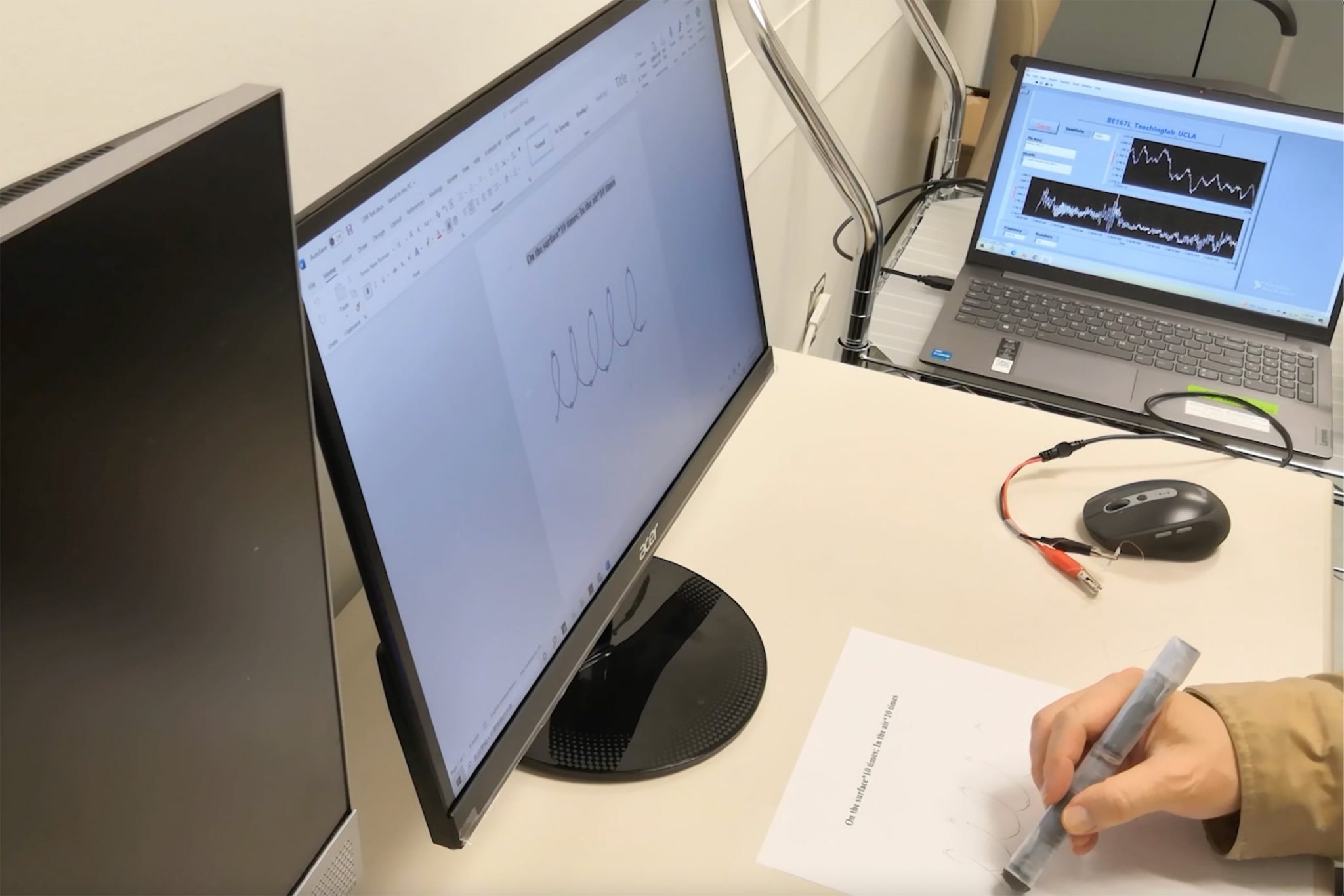 Researchers diagnose Parkinson’s with 3D printed pen