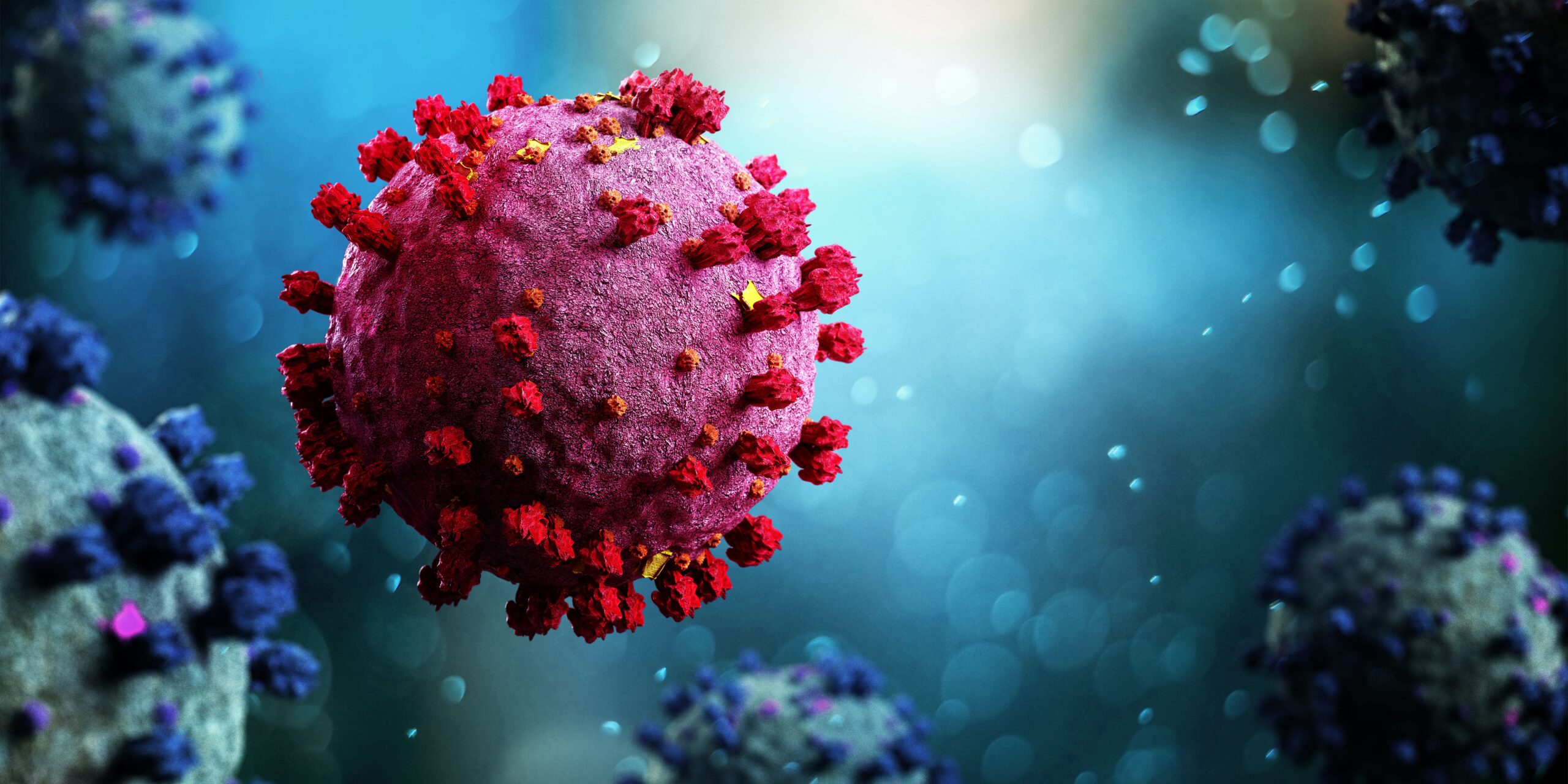 Severe COVID-19 Linked to Higher Exacerbation, Mortality Risks in Patients With Bronchiectasis