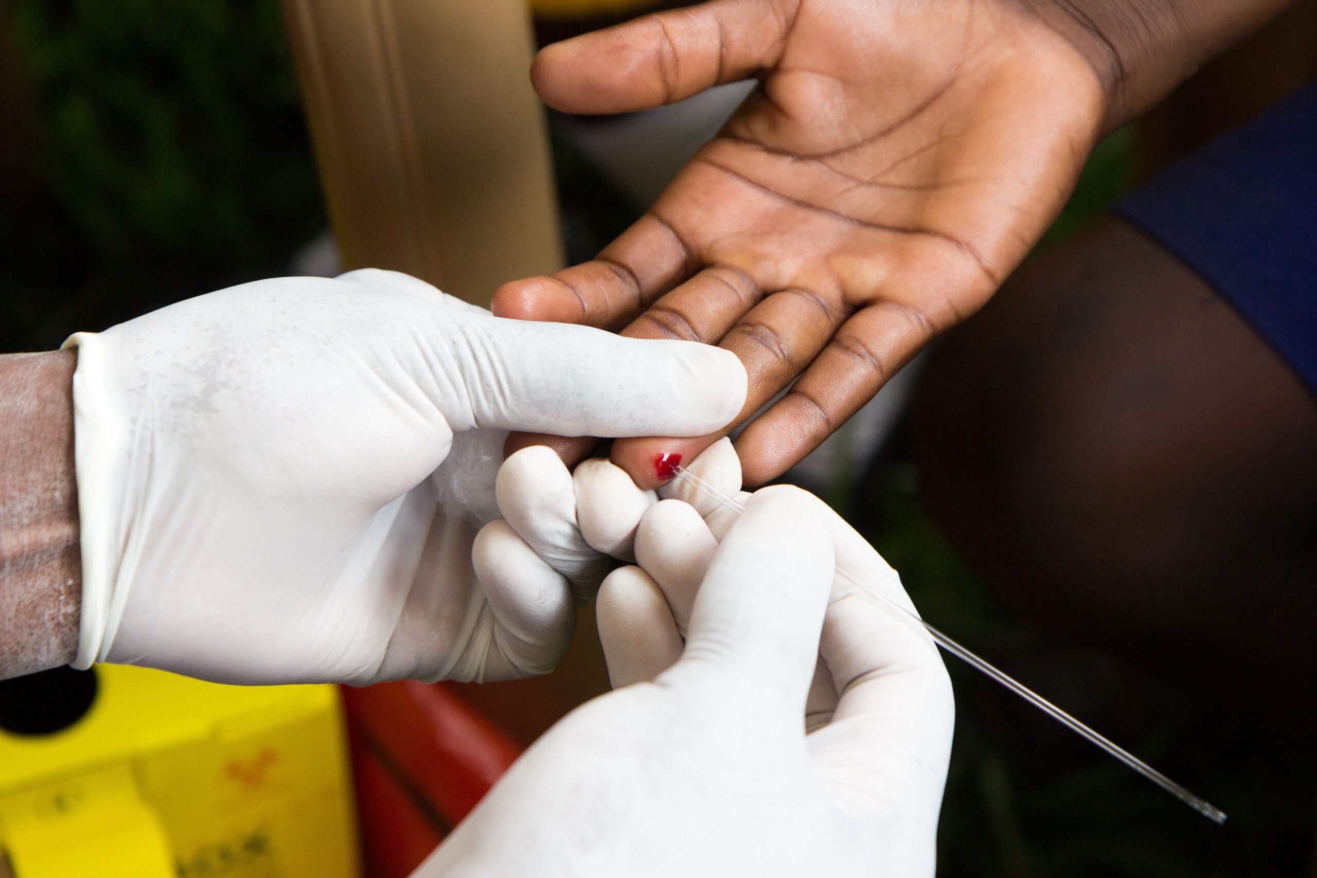 Consequence of U.S. HIV Funding Cuts Are Showing, Threatening Years of Gains, Say Researchers