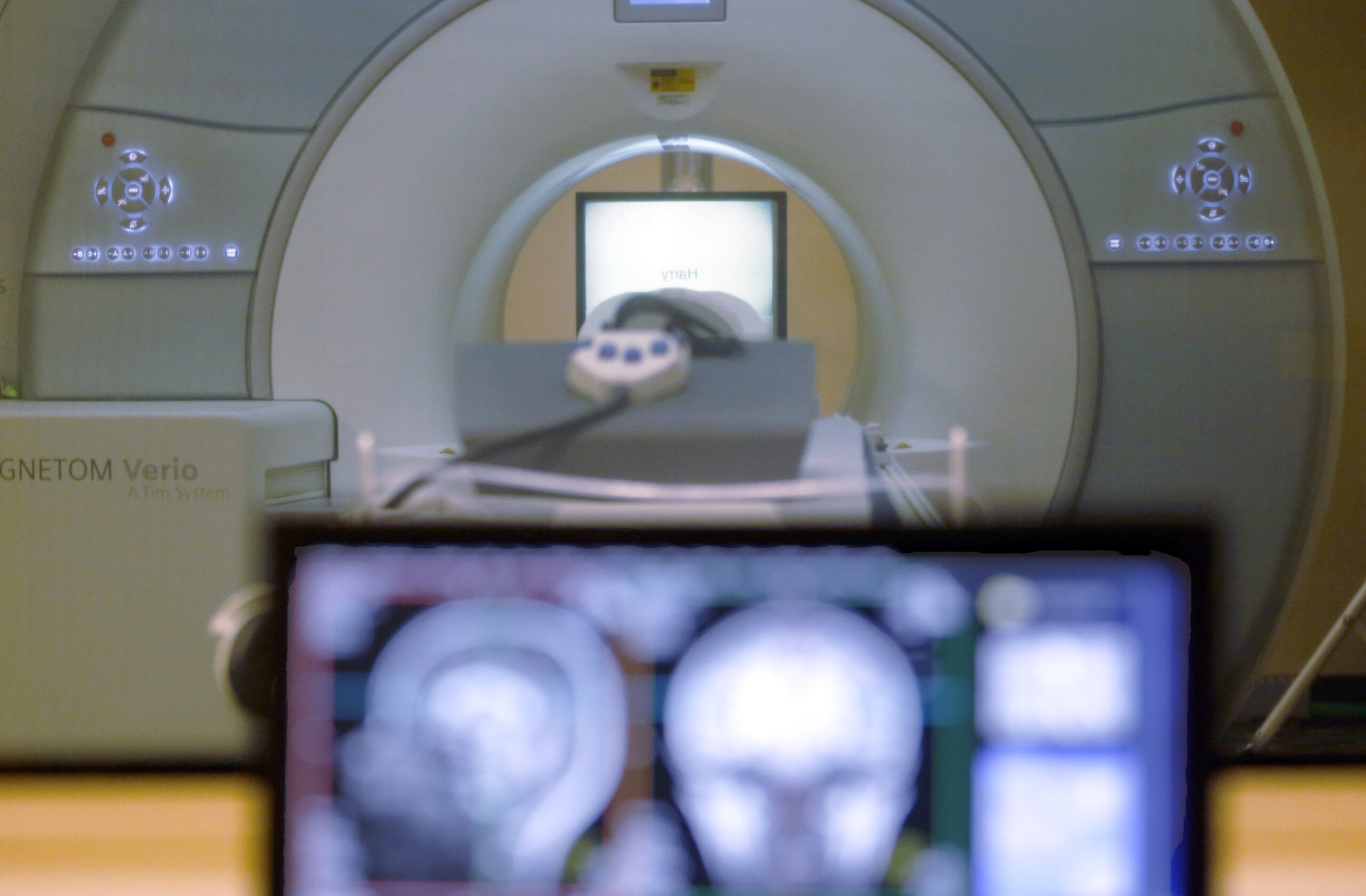 Epilepsy treatment research could bring patients closer to a ‘seizure-free’ life
