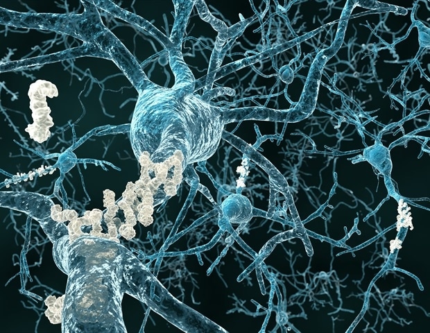 TET2 mutations in blood stem cells linked to lower Alzheimer’s risk