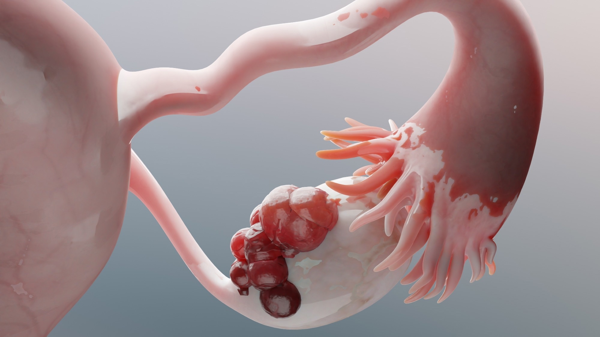 Probiotics improve ovarian damage in premature menopausal mice