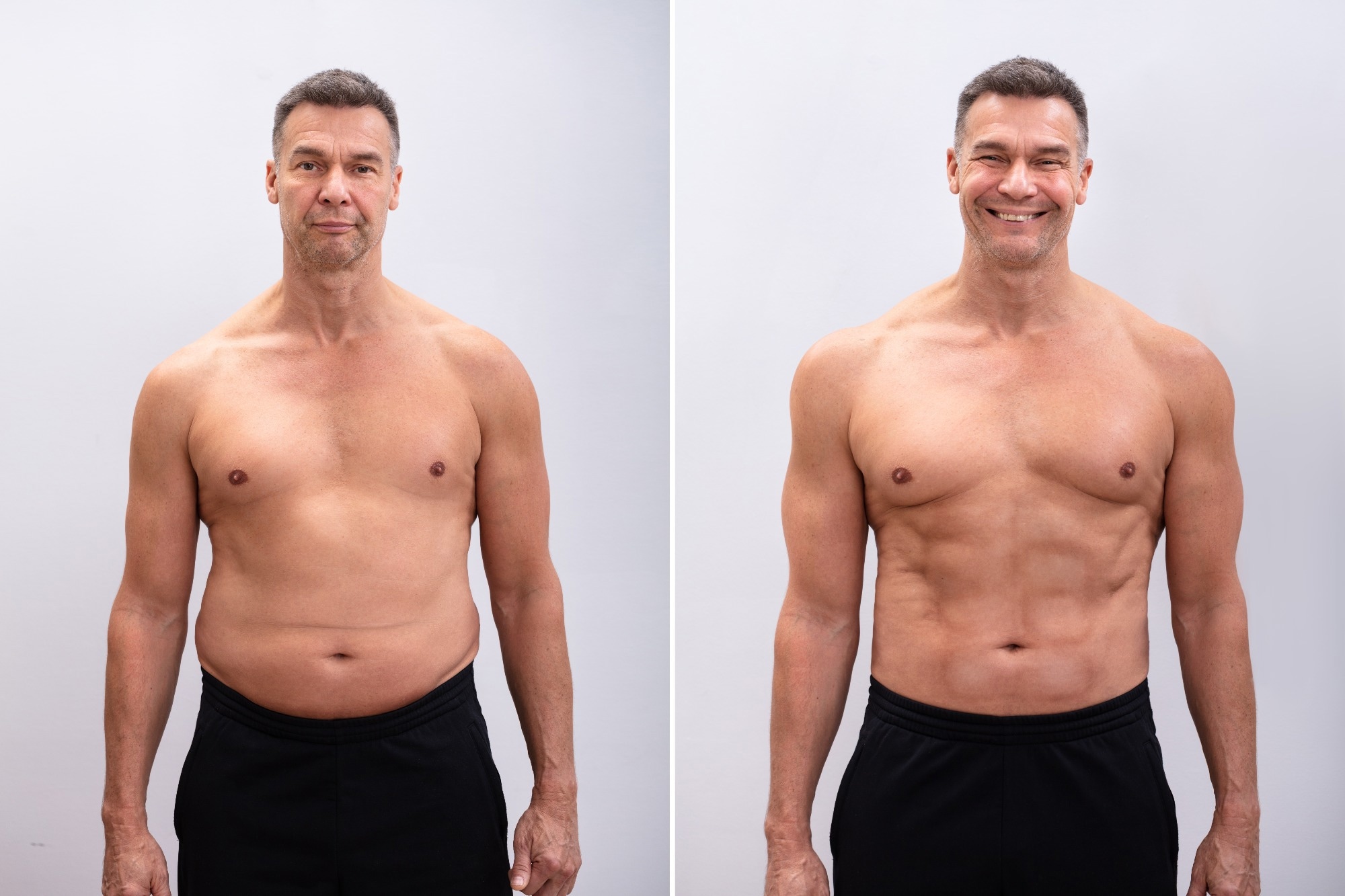 Weight loss wipes out senescent fat cells but leaves immune scars, study finds