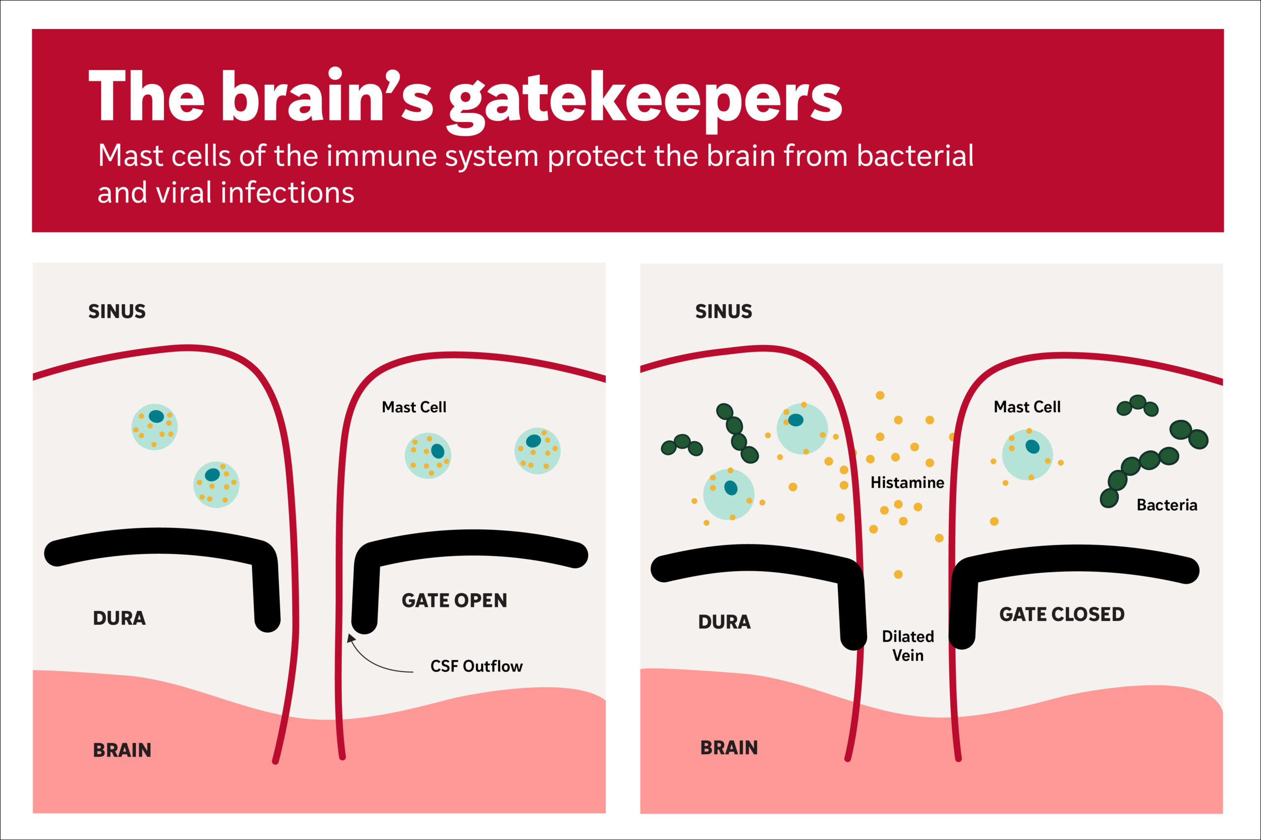 Schematic shows mast cells release histamine in the presence of bacteria in the surrounding tissues of the brain