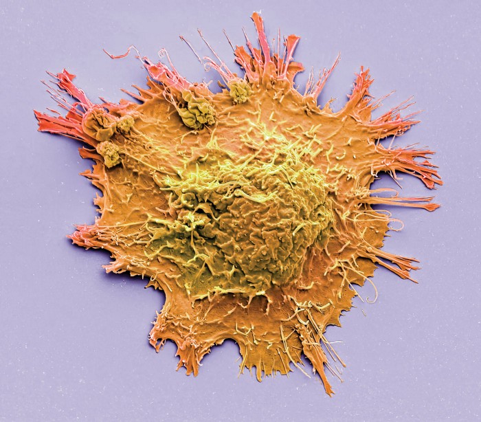 New myosin inhibitors can drug the brain without stopping the heart