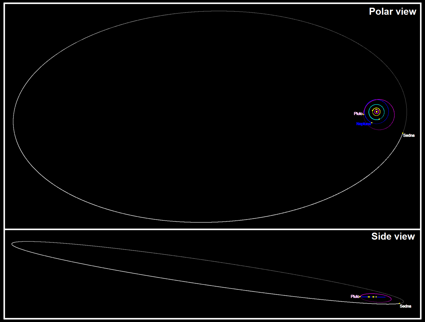 Visiting Our Neighbor Sedna: Feasibility Study Of A Mission To This Planetoid
