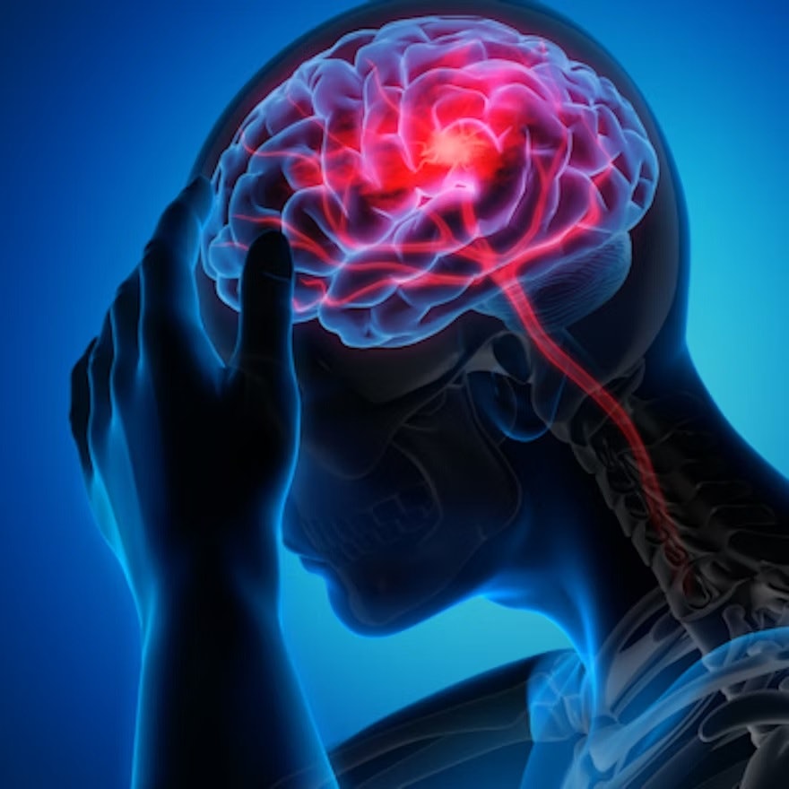 Stenting shows little benefit over medical therapy for reducing stroke