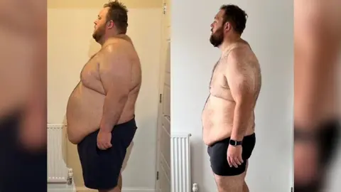James Baker A side by side comparison image of a man after losing 19.5st. He was once 38st. He is stood looking to the side, wearing just black shorts in both images. 