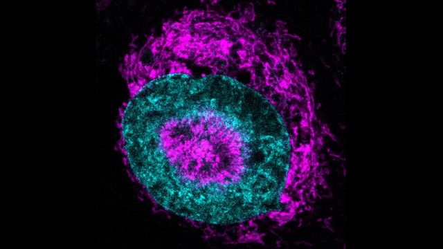 Mechanical Stress in Cancer Cells Activates Mitochondria