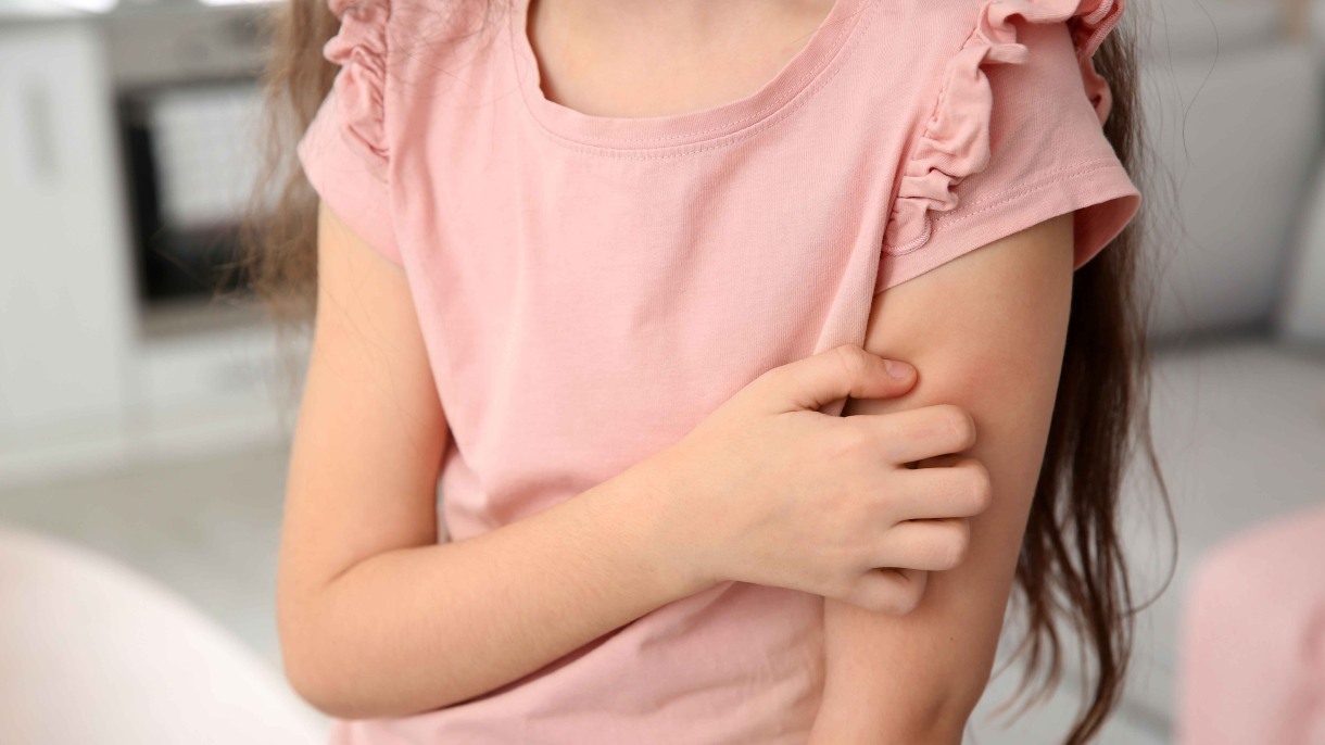 Antimicrobial common in everyday items linked to allergic conditions in children