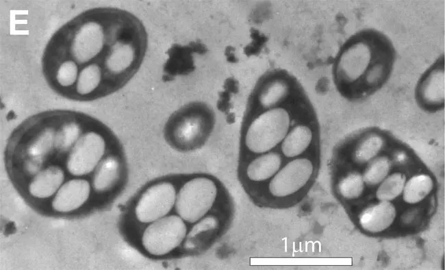 A black and white image of several bacteria under a microscope.