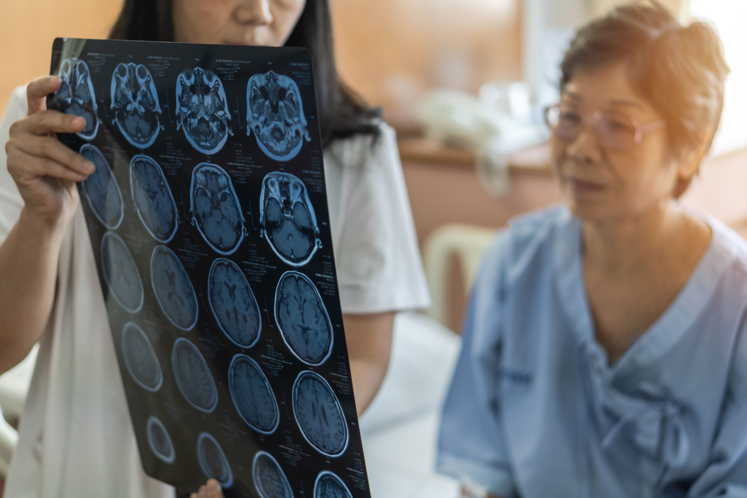 Pregnancy complications linked to long-term stroke risk