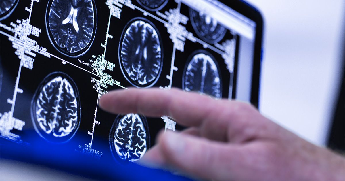 Novel brain scan may predict age-related disease