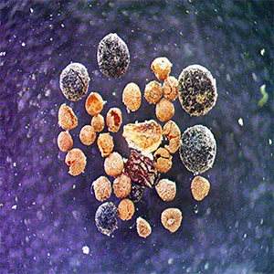 Willow bud scale, arctic poppy seed, fungal bodies, and rock spikemoss megaspores found in the GISP2 soil sample viewed under a microscope at the University of Vermont. Click image to enlarge. Credit: Halley Mastro/University of Vermont