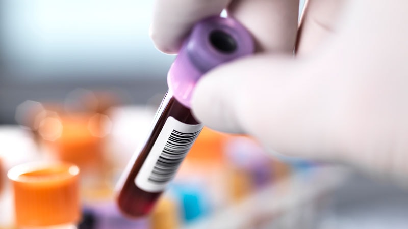 13 Cancers in One Blood Test — but 75% False Alarms