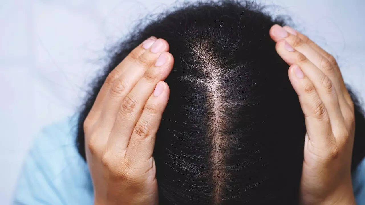 Hair loss may be reversible through restored molecular signals: New study finds
