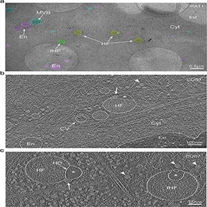 Cryo-electron tomography observation of hemifused vesicles at the leading edge of cultured cells. Credit: Nature Communications (2025)