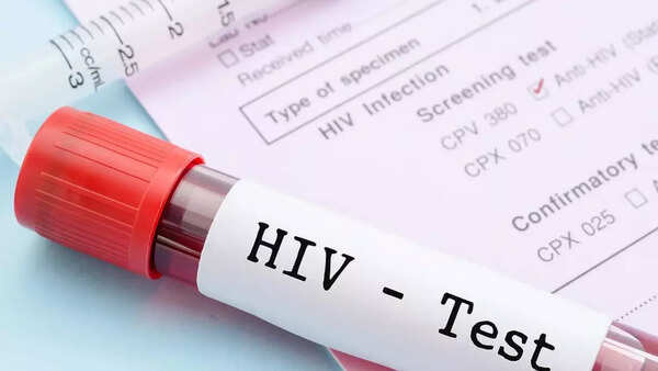 HIV AIDS (1)