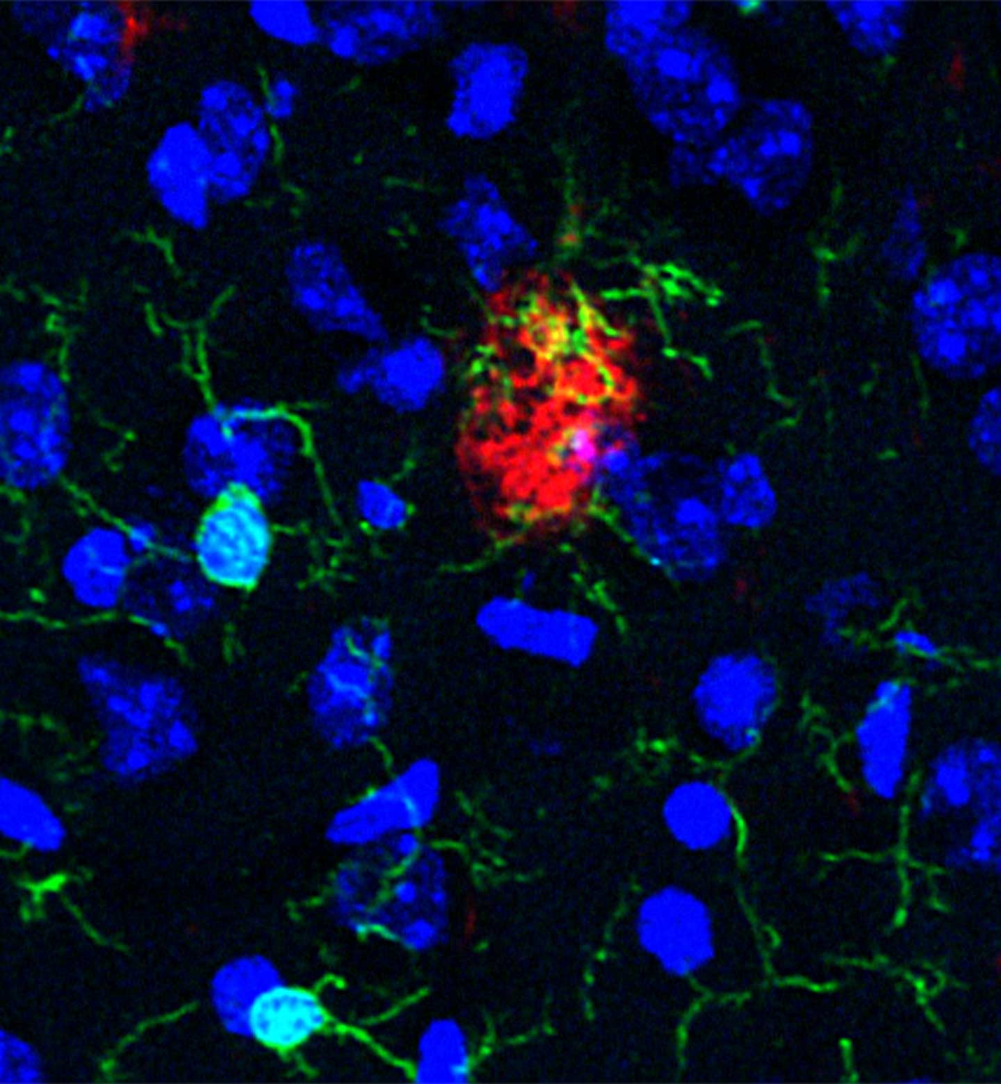 These Immune Cells Eat Molecular Trash to Keep Alzheimer’s at Bay