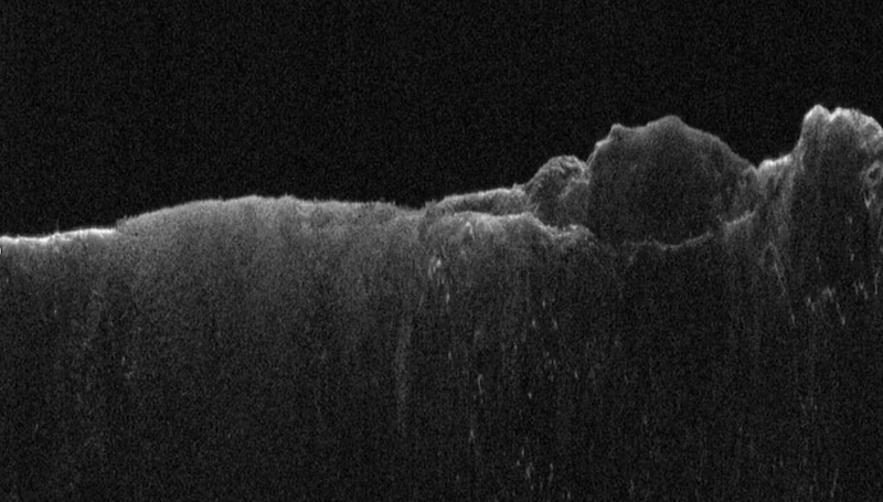 Gray mountain-like ledge with black sky above it.