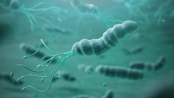 Stomach cancer (2)