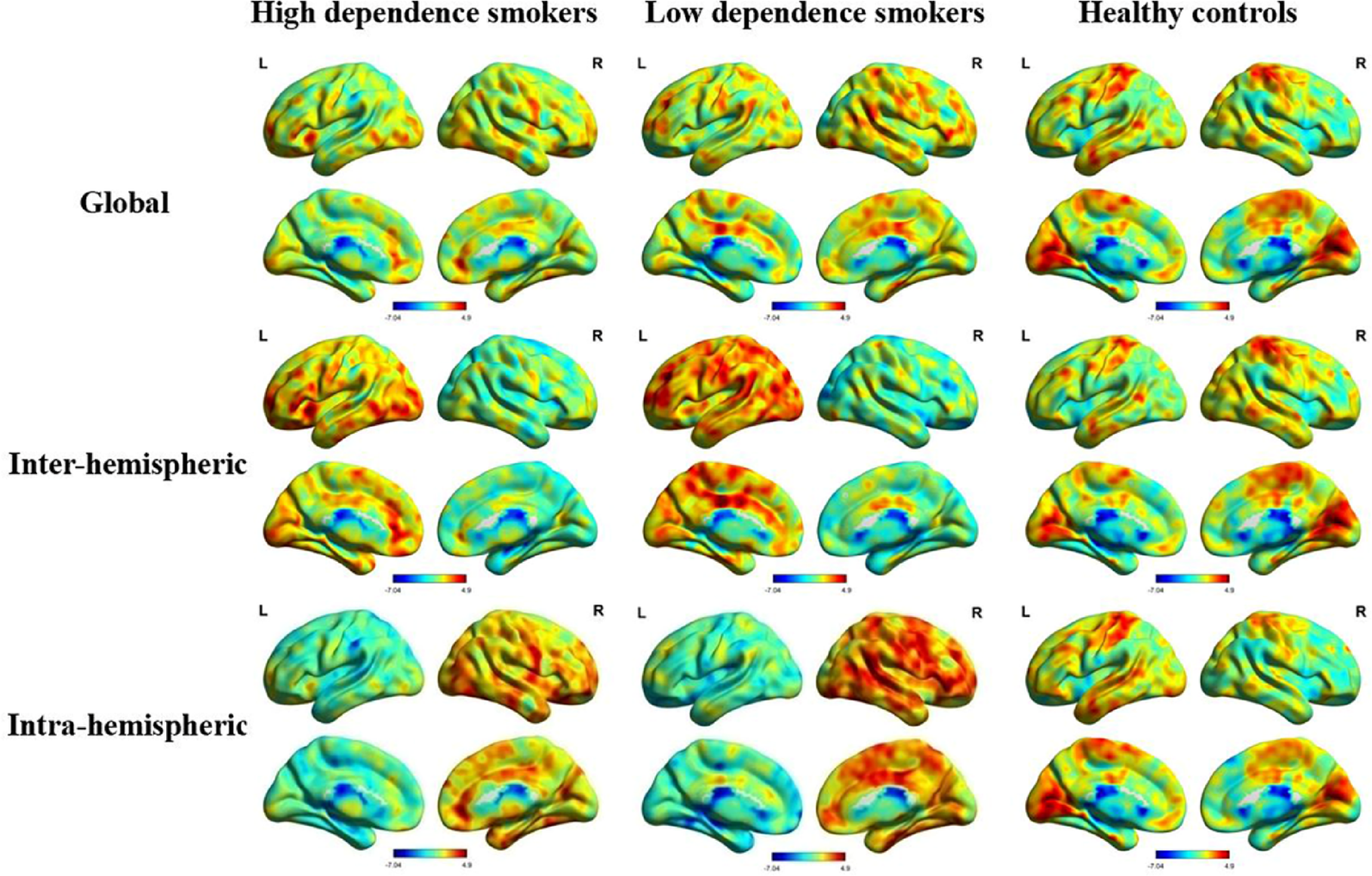 Altered inter-hemispheric and intra-hemispheric functional connectivity dynamics in male cigarette smokers | BMC Psychiatry