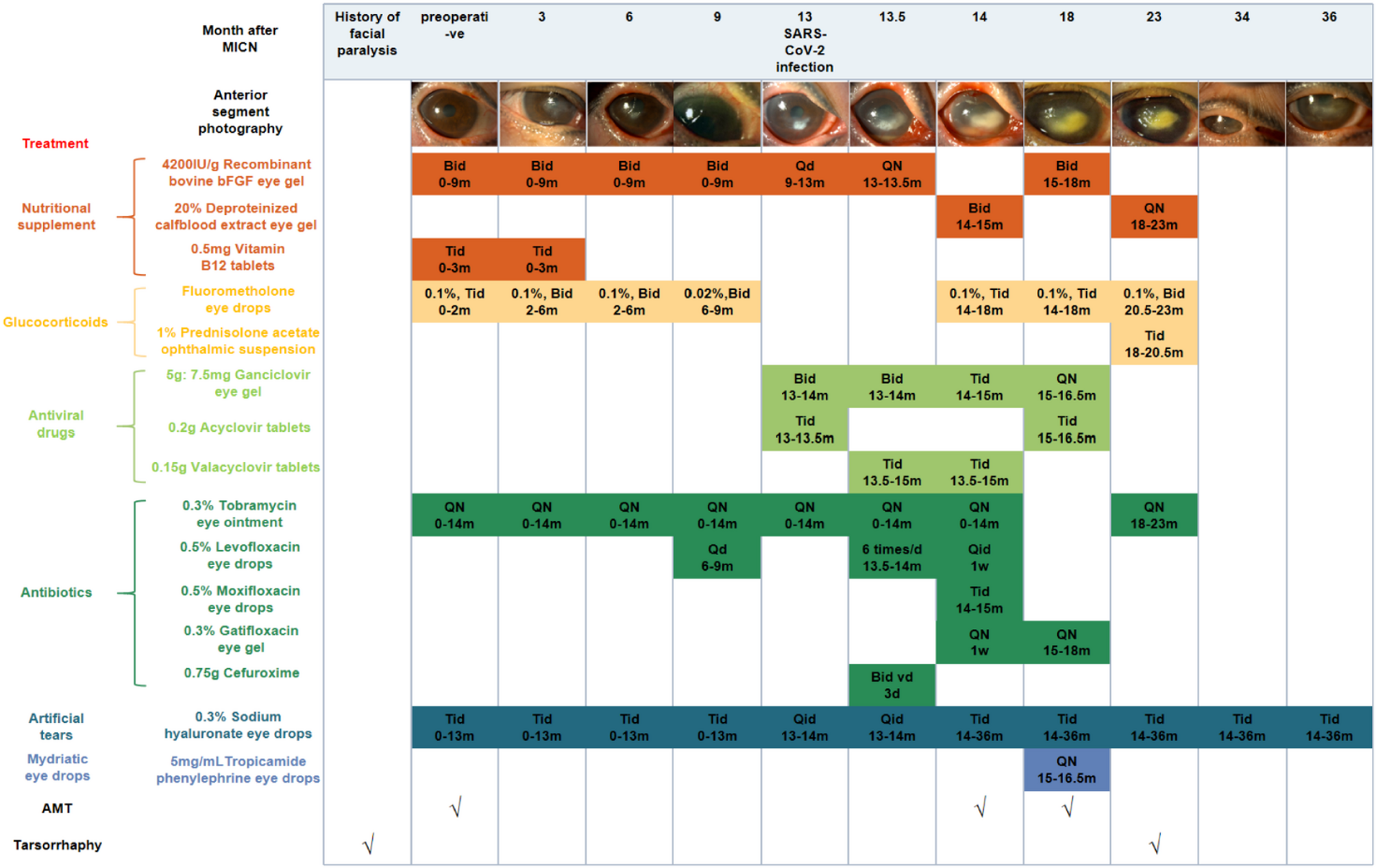 Corneal neurotization meets COVID-19: a case report of minimally invasive corneal neurotization complicated by COVID-19-related keratitis | Journal of Ophthalmic Inflammation and Infection