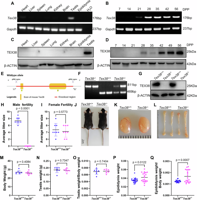 Disruption of TEX38 impairs sperm morphogenesis and the migration of sperm into the oviduct