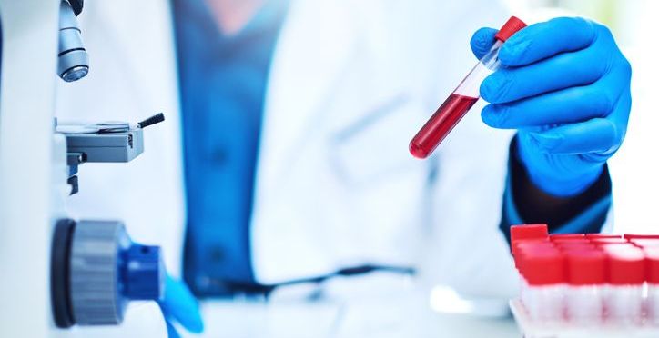Models Based on Serum Proteomics Improve Risk Prediction in ADPKD – Docwire News
