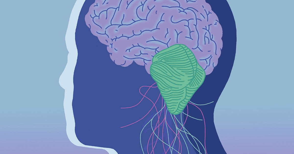 What to Know About Symptoms, Diagnosis, and Life After Surgery