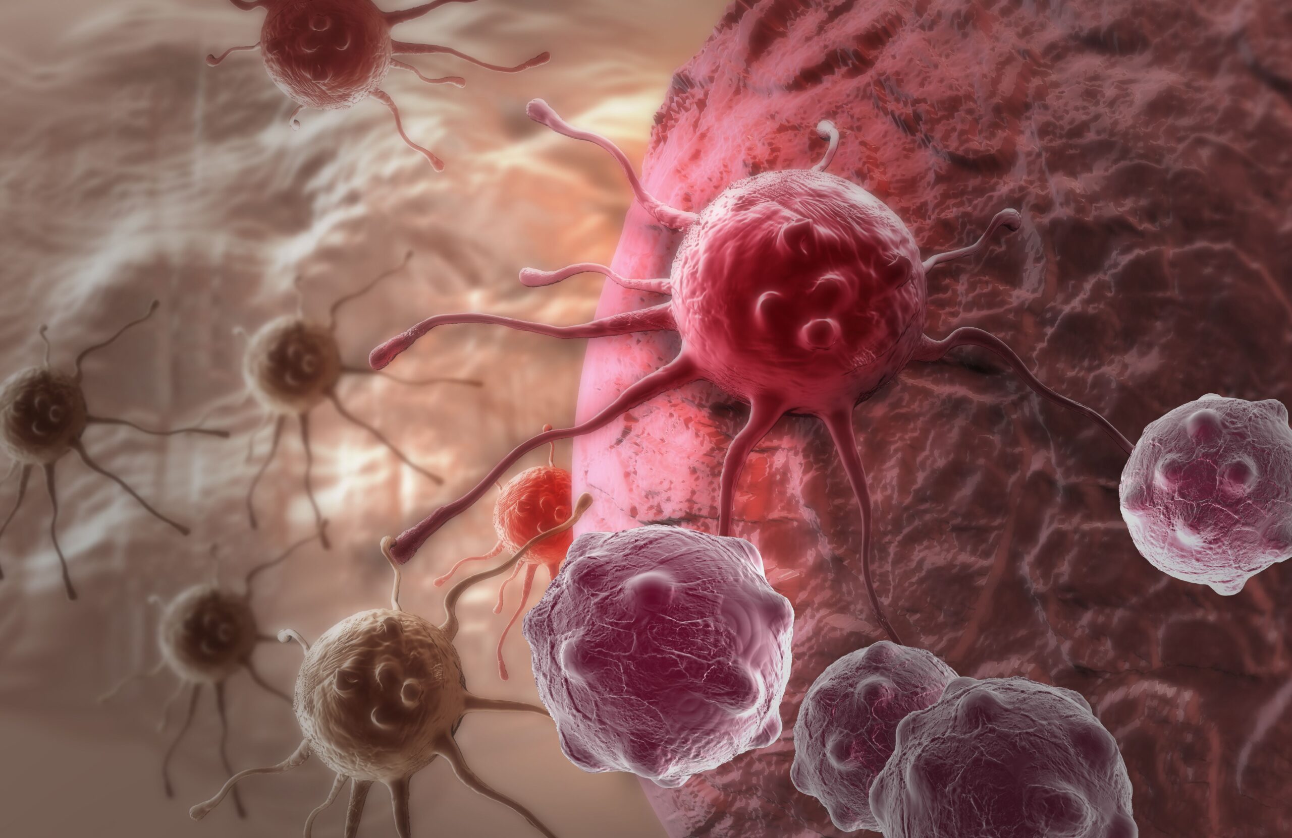 Novel Cancer Vaccine Combo Therapy Numerically Improves PFS in Melanoma