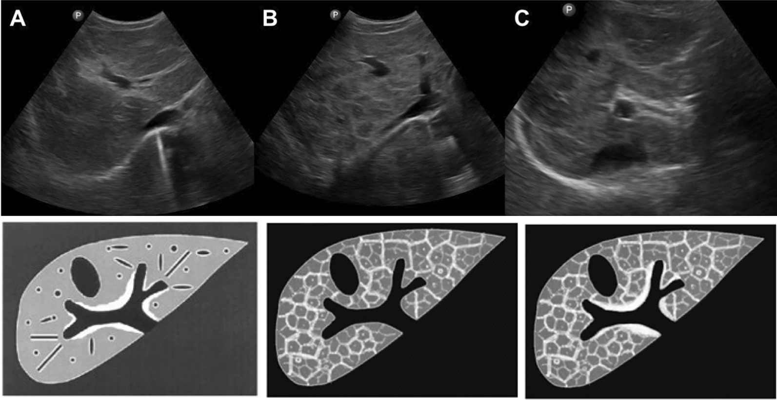 The Basel ultrasonography protocol for assessing hepatosplenic pathologies in Asian schistosomiasis: report of a WHO expert meeting | Infectious Diseases of Poverty