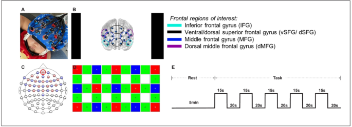 Task-based functional connectivity in infants after exposure to regular white noise during natural sleep measured by fNIRS