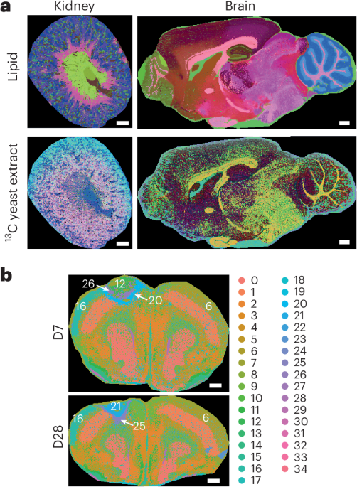 Unlocking spatial metabolomics with isotopically labelled internal standards