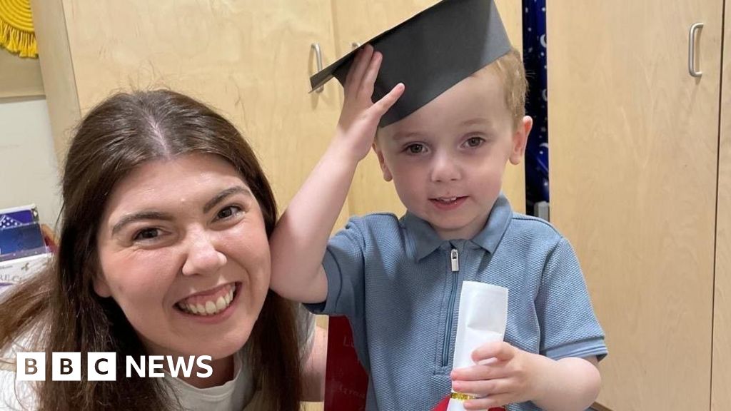 ‘My son’s head size led to doctors spotting rare vein condition’