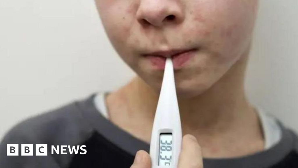 Measles warning for parents in East Sussex