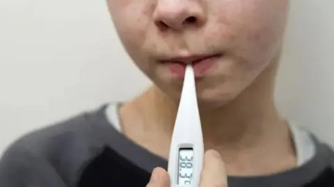 Getty Images A close up of the bottom half of a young child's face - there is a blotchy rash on the youngster's face, and a thermometer in their mouth