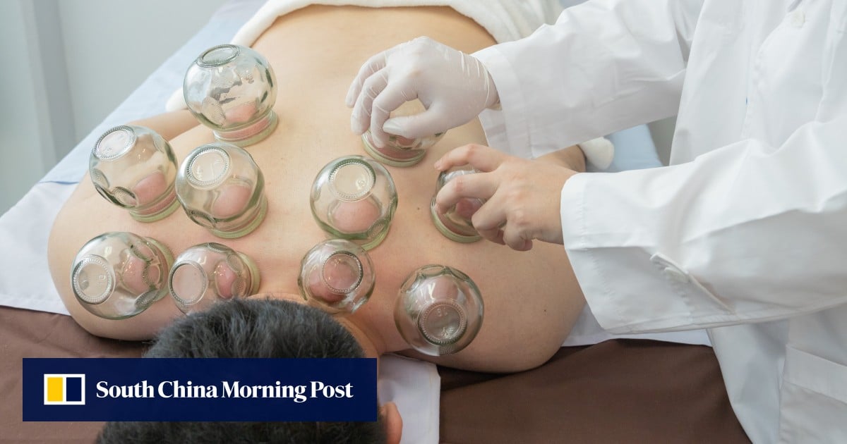 How traditional Chinese medicine can help you lose weight, from acupuncture to cupping