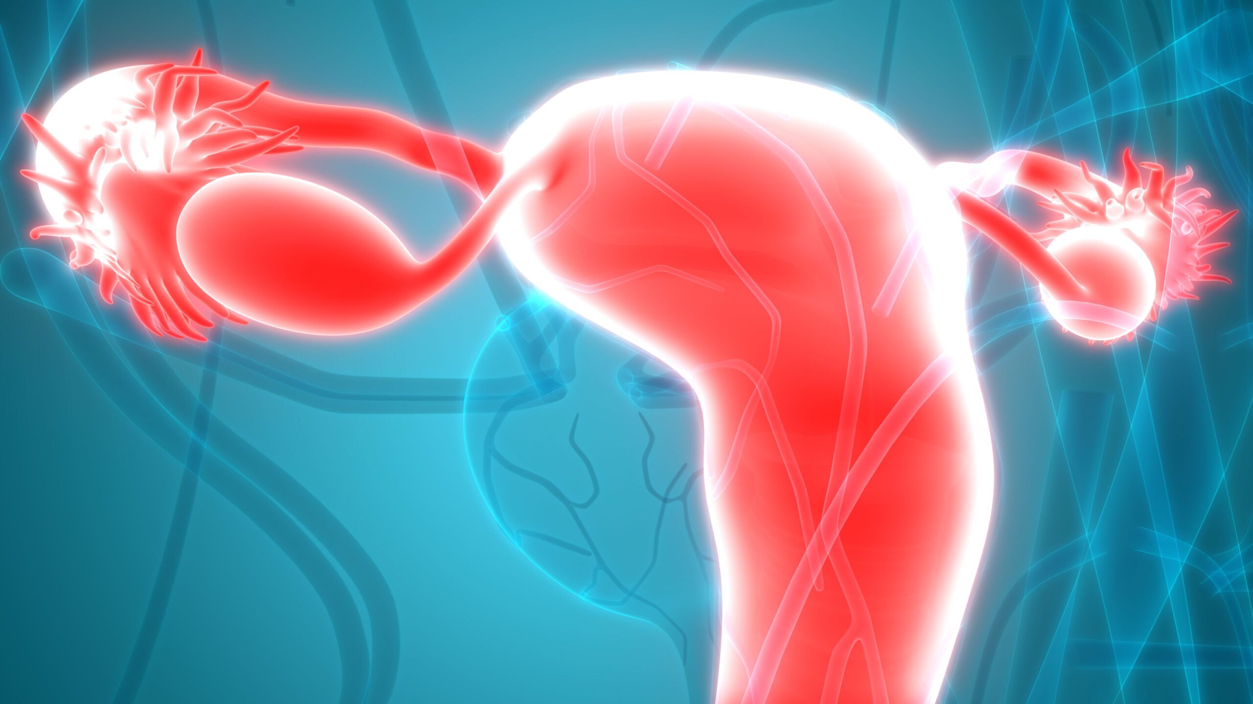 Alpelisib Combo Does Not Extend PFS in High-Grade Serous Ovarian Cancer
