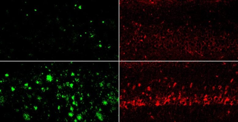 Comparison of Amyloid and Tau in Treated Mice